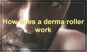 How does a derma roller work
