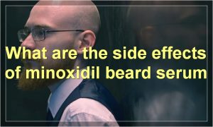 What are the side effects of minoxidil beard serum