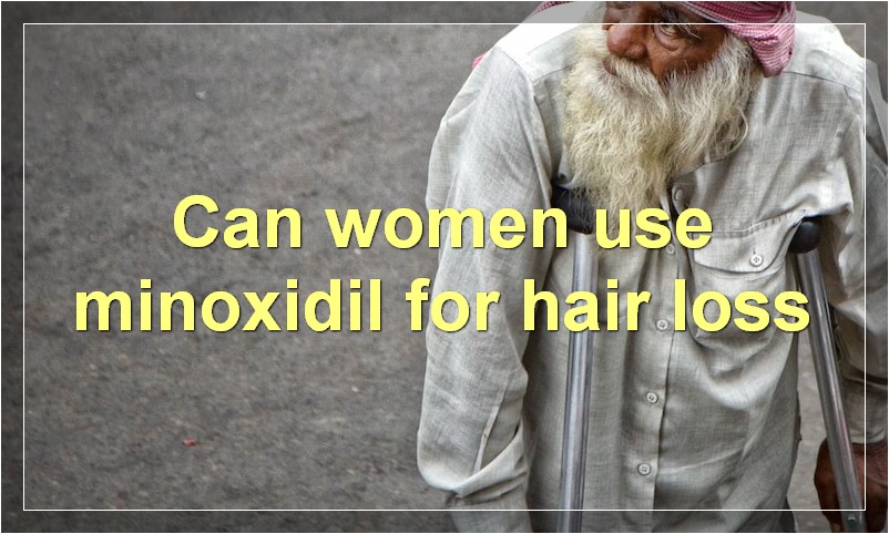 Can women use minoxidil for hair loss