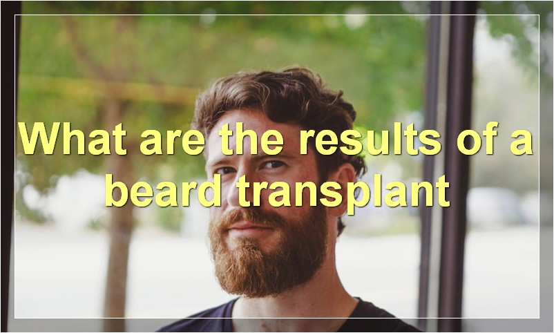 What are the results of a beard transplant