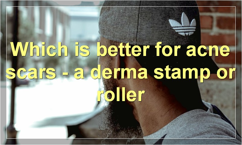 Which is better for acne scars - a derma stamp or roller